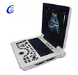 Optional 3D  Ultrasound